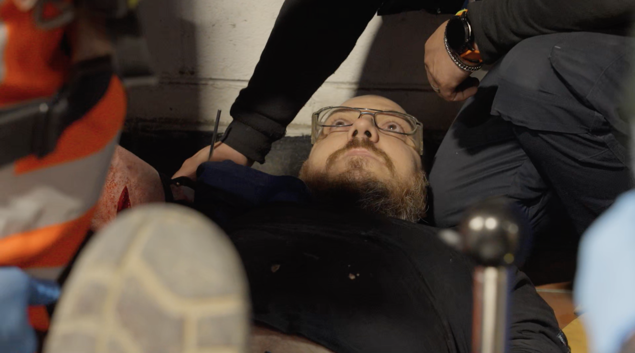 Factory Worker’s Arm Saved Following Horrific Grinder Accident in ...